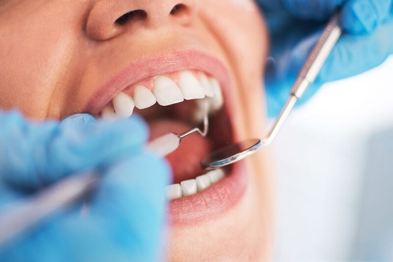 Preventative Dental Exam Cary