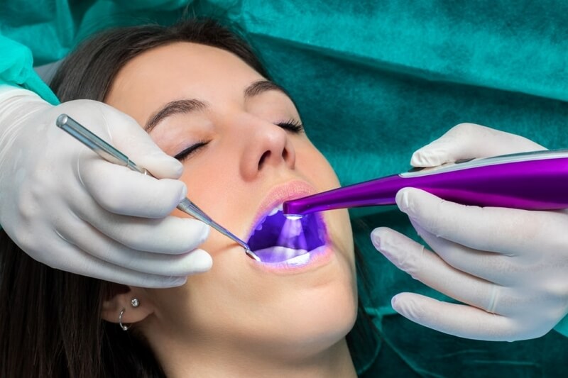 Dental Sealants Cary NC