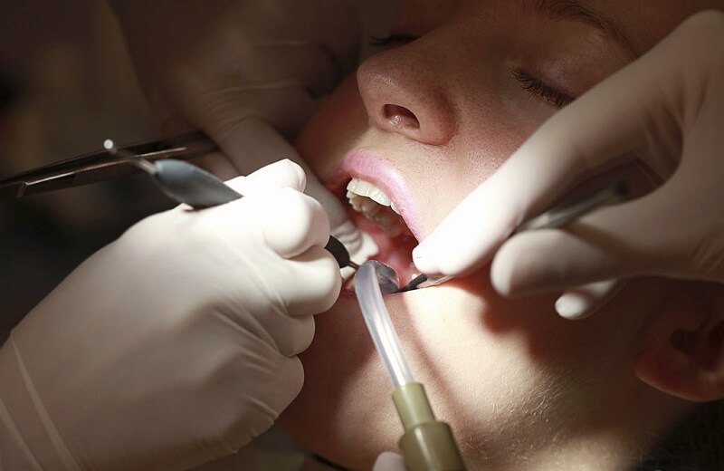 Dental Surgery Cary NC