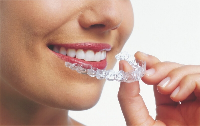 Invisalign Dentist in Cary NC