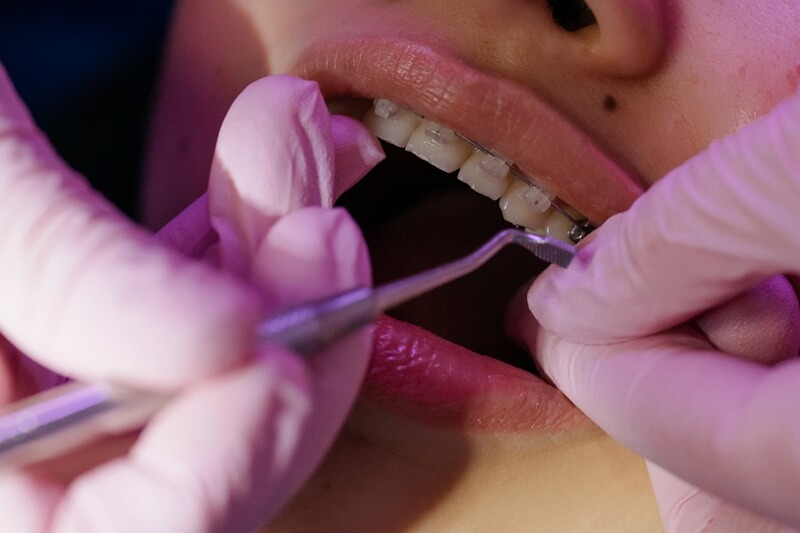 Orthodontics Cary NC