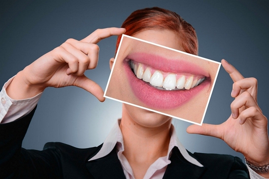DentalImplants Dental Implants