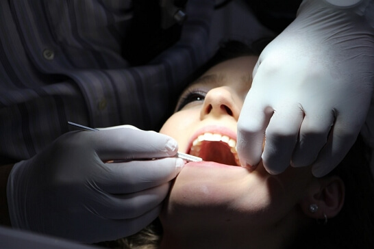 RootCanals Root Canals