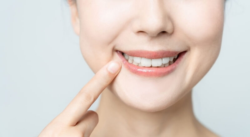ToothColoredFillings Tooth Colored Fillings